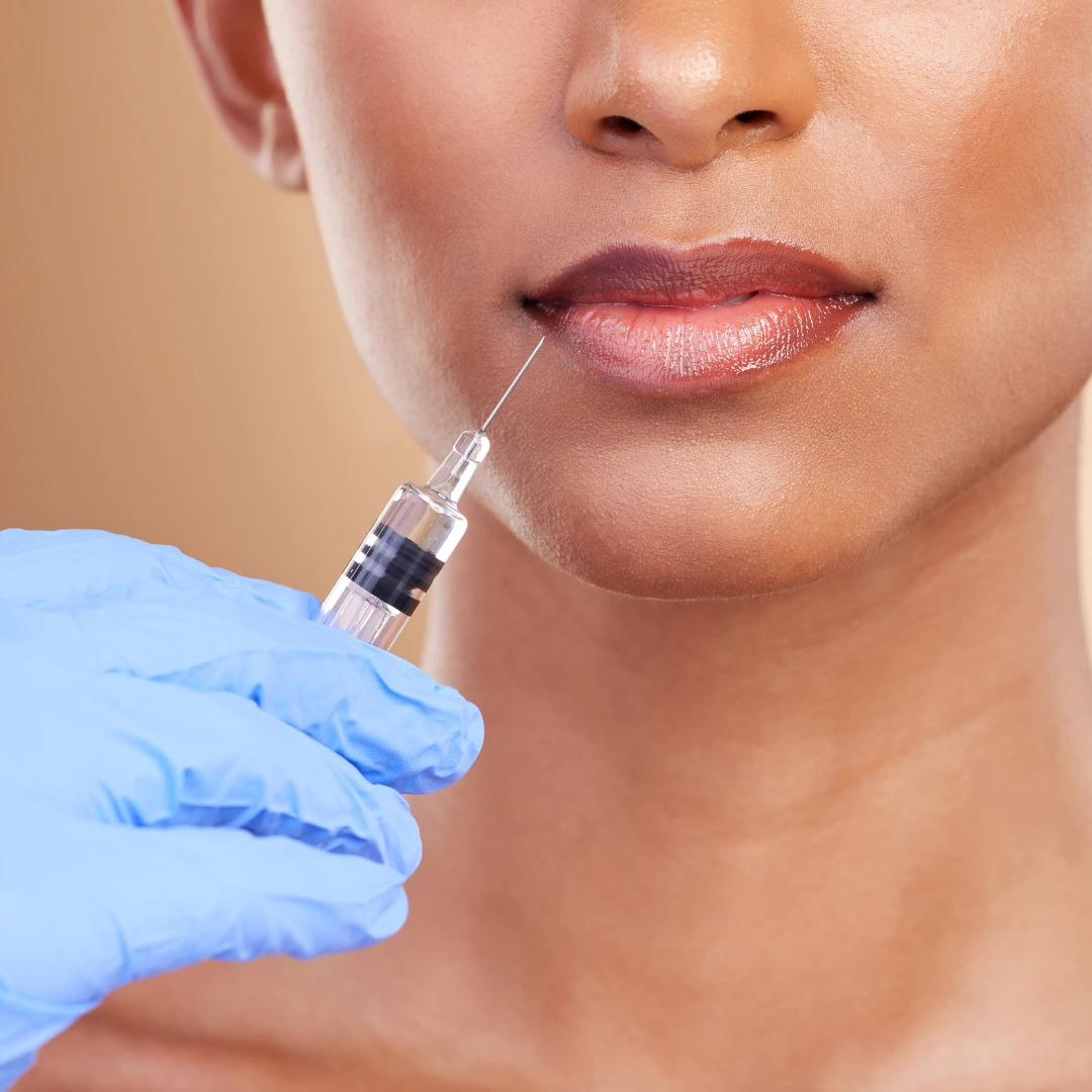 Are Dermal Fillers the Key to Smooth, Scar-Free Skin? An In-Depth Look