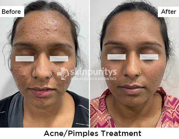 ishigaki glutathione vs luminious Glutathione Vs Other Skin Brightening Treatments Explained