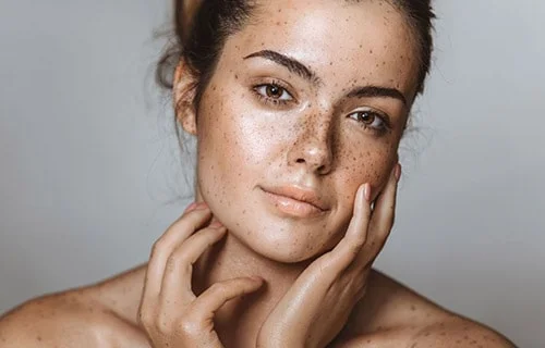 Pigmentation Treatment in Indore