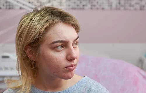 Open Pores Treatment in Indore